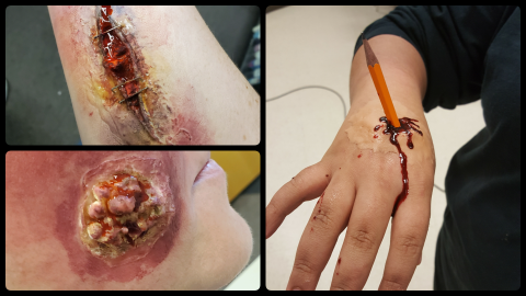Three photos of wounds on people using special effects makeup. The top left has an open wound with blood and staples on an arm. The bottom left has an open would with pus on a cheek. The right one has a pencil sticking out of a hand with blood trickling out.